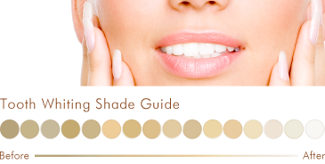 Tooth Whiting Shade Guide